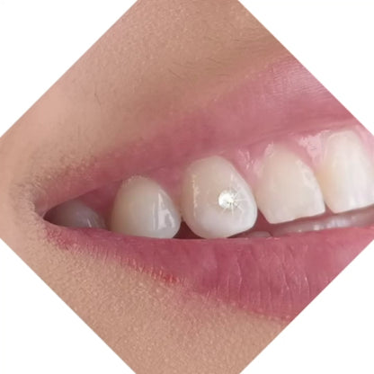 Tooth Gem Starter Kit
