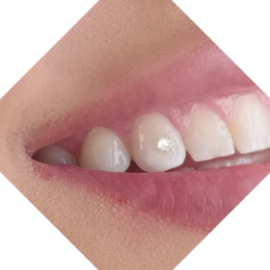 Tooth Gem Starter Kit